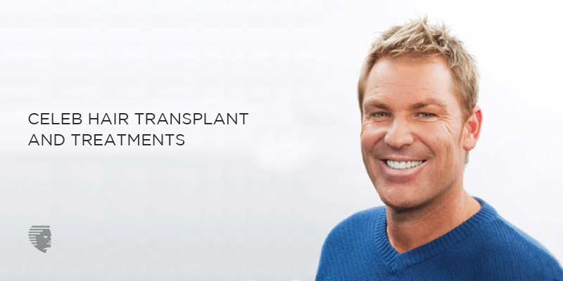 Some handsome celebrities you never knew had a hair transplant