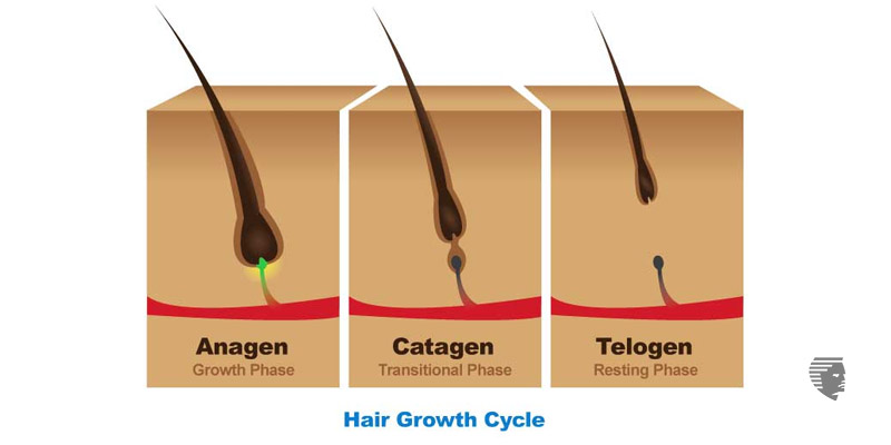 Telogen Effluvium – a common form of hair loss