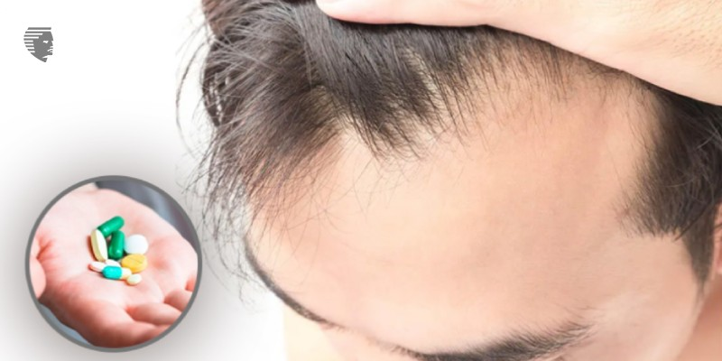 Medication that can cause hair loss & how to prevent it?