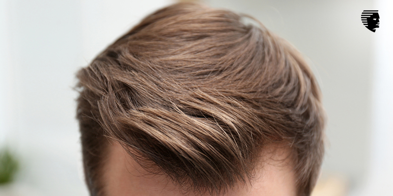 What Will You Look Like After a Hair Transplant?