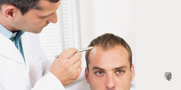 Specialized Hair Transplants for Different Ethnicities- UAE