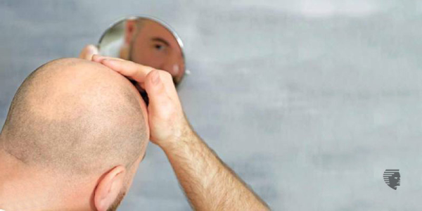 Regain your Lost Confidence with this Painless Non-Surgical Hair Replacement Procedure!
