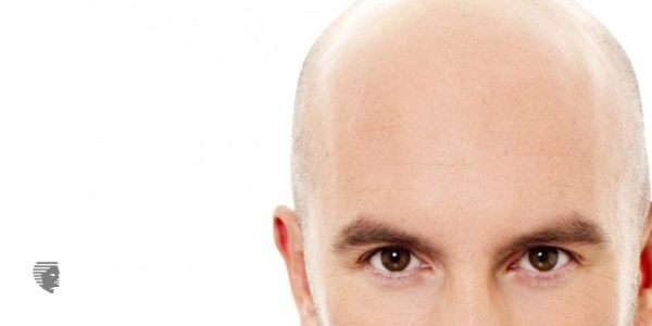 The Cost Of Hair Transplant And Everything Else You Need To Know