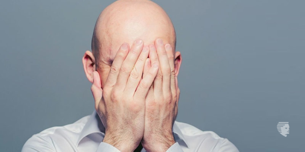 The Psychological Impact of Balding