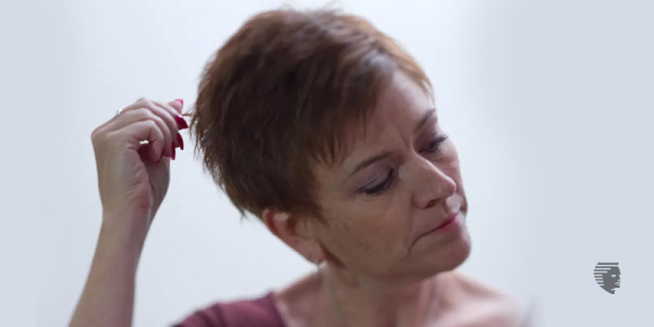 Is Trichotillomania a reason of your hair loss?