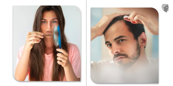 Hereditary Hair Loss in Males and Females