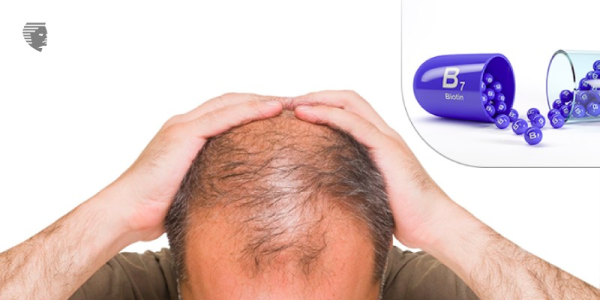 Can Biotin Help To Prevent Hair Loss