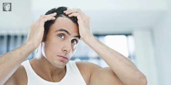 Everything You Should Know About a Receding Hairline