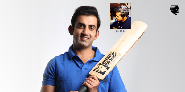 Gautam Joins The Winning Team and Hits Hair Loss for a Six!