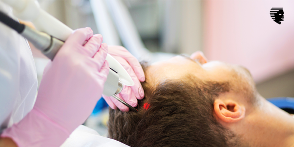 Low-Level Laser Therapy (LLLT) - How Does It Work and Is It an Effective Treatment for Hair Loss?