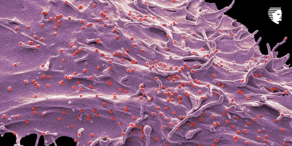 Exosomes in Treating Hair Loss: A Revolutionary Approach?