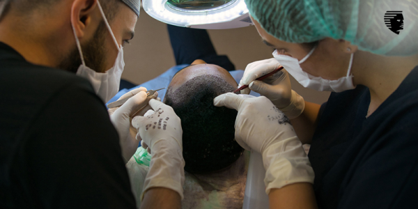 What Makes Someone A Good Candidate For A Hair Transplant?