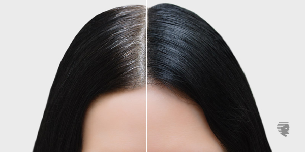 7 Home Remedies for Grey Hair Treatment
