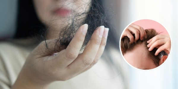 Hair Transplant Vs Hair Loss Solutions: A Comparison Guide