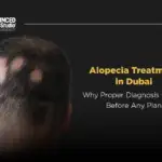 Alopecia Treatment in Dubai – Why Proper Diagnosis Comes Before Any Plan