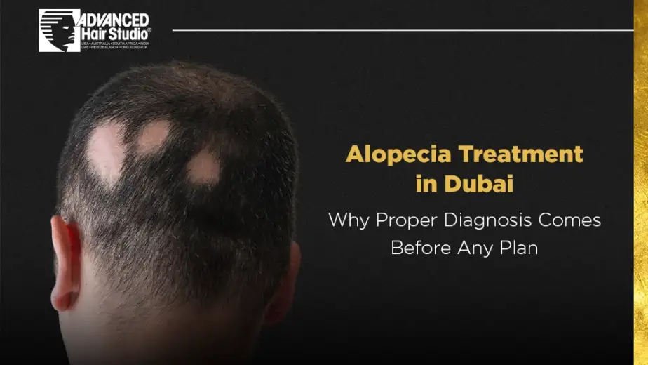 alopecia treatment dubai