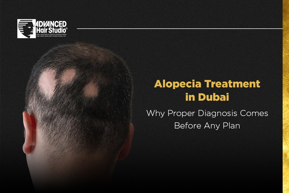 alopecia treatment dubai