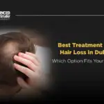 Best Treatment for Hair Loss in Dubai – Which Option Fits Your Stage?