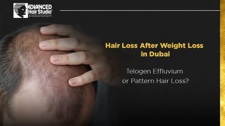Hair Loss After Weight Loss in Dubai