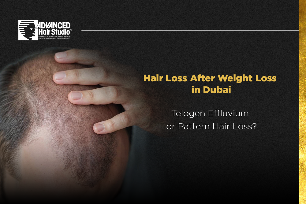 Hair Loss After Weight Loss in Dubai