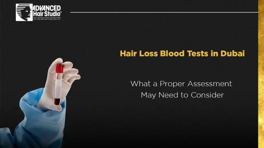 hair loss blood tests dubai
