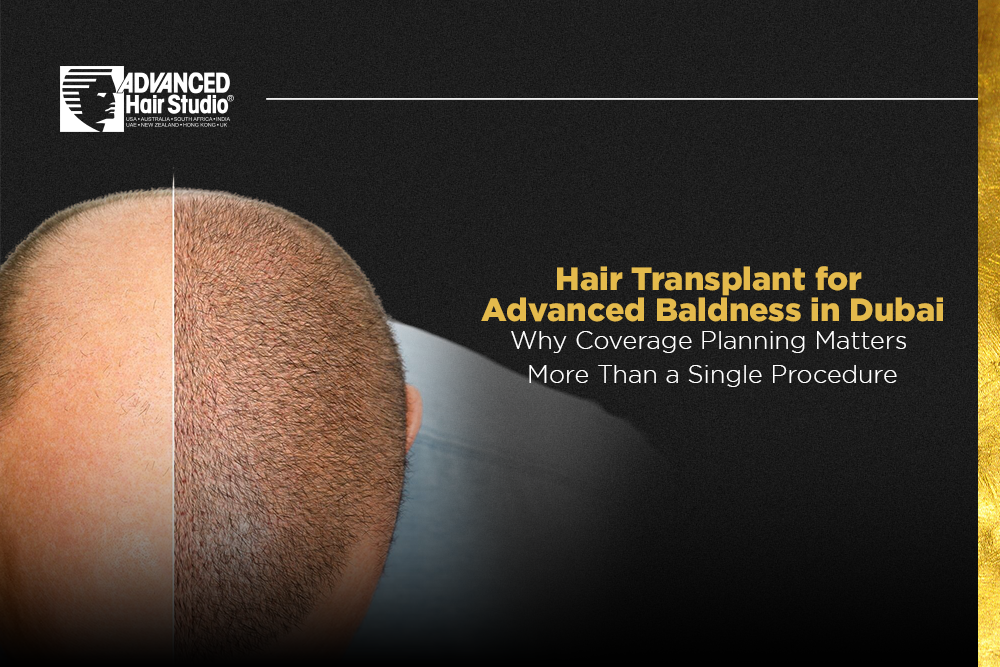 hair transplant for advanced baldness dubai