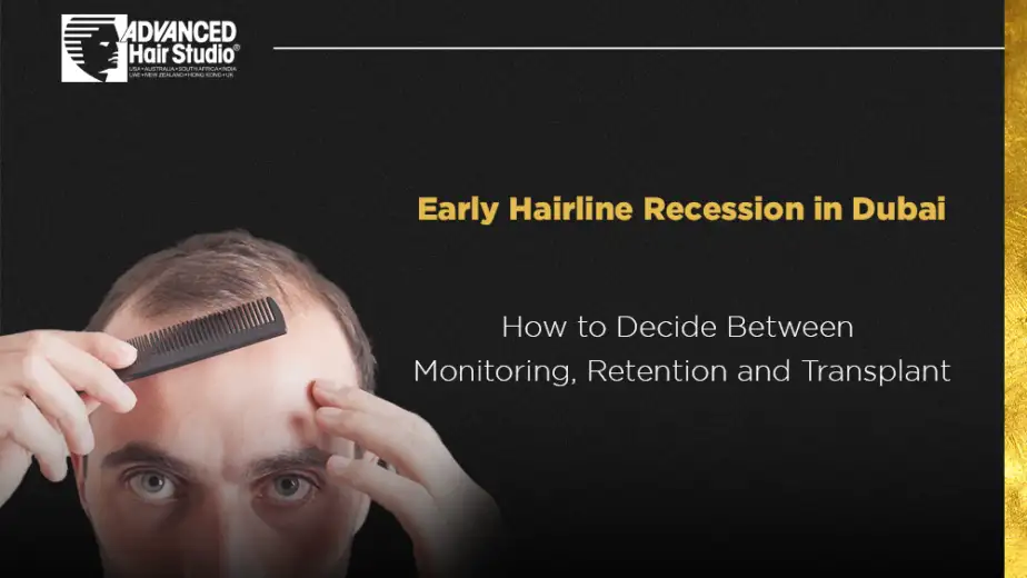 early hairline recession dubai
