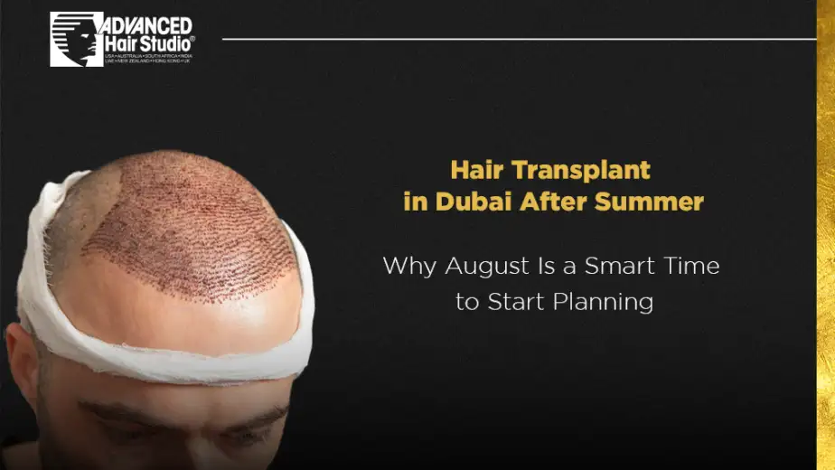 hair transplant after summer dubai